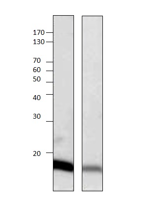 Western blot - Anti-G0/G1switch 2/G0S2 antibody - C-terminal (AB183465)