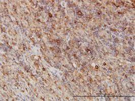 Immunohistochemistry (Formalin/PFA-fixed paraffin-embedded sections) - Anti-G3BP antibody [2F3] (AB56574)