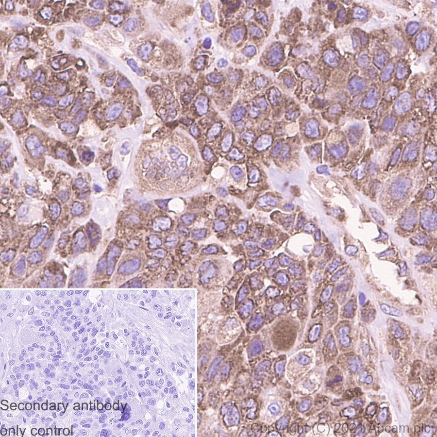 Immunohistochemistry (Formalin/PFA-fixed paraffin-embedded sections) - Anti-G3BP antibody [EPR13985(B)] (AB181149), expandable thumbnail