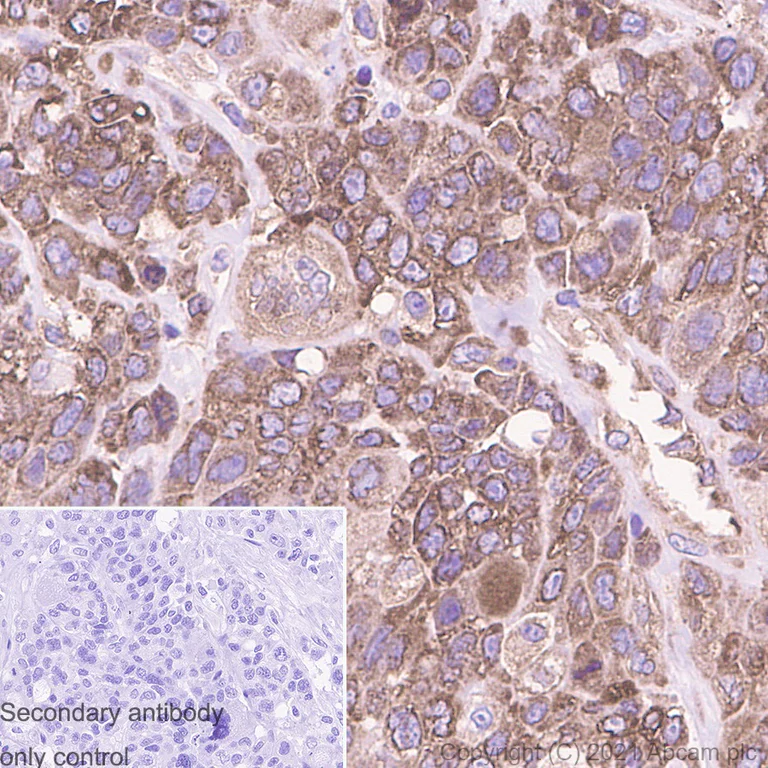 Immunohistochemistry (Formalin/PFA-fixed paraffin-embedded sections) - Anti-G3BP antibody [EPR13985(B)] (AB181149)