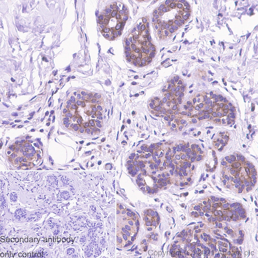 Immunohistochemistry (Formalin/PFA-fixed paraffin-embedded sections) - Anti-G3BP antibody [EPR13985(B)] (AB181149), expandable thumbnail