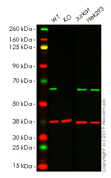 Western blot - Anti-G3BP antibody [EPR13985(B)] (ab181149), expandable thumbnail