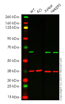 Western blot - Anti-G3BP antibody [EPR13985(B)] (AB181149)