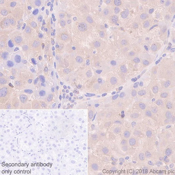 Immunohistochemistry (Formalin/PFA-fixed paraffin-embedded sections) - Anti-G3BP antibody [EPR13986(B)] (AB181150)