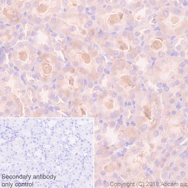 Immunohistochemistry (Formalin/PFA-fixed paraffin-embedded sections) - Anti-G3BP antibody [EPR13986(B)] - BSA and Azide free (AB240247)