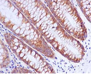 Immunohistochemistry (Formalin/PFA-fixed paraffin-embedded sections) - Anti-G3BP antibody [EPR13986(B)] - BSA and Azide free (AB240247)