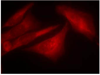 Immunocytochemistry/ Immunofluorescence - Anti-G3BP (phospho S232) antibody (AB131243), expandable thumbnail