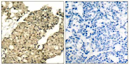 Immunohistochemistry (Formalin/PFA-fixed paraffin-embedded sections) - Anti-G3BP (phospho S232) antibody (AB131243), expandable thumbnail
