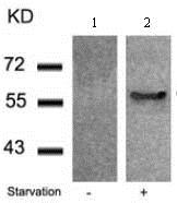 Western blot - Anti-G3BP (phospho S232) antibody (AB131243), expandable thumbnail