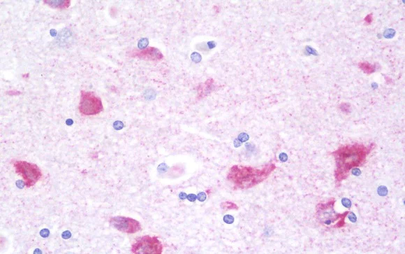 Immunohistochemistry (Formalin/PFA-fixed paraffin-embedded sections) - Anti-G3BP2 antibody (AB190011)