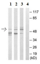 Western blot - Anti-G3BP2 antibody (AB190011)