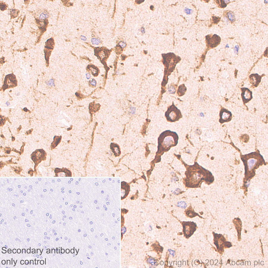 Immunohistochemistry (Formalin/PFA-fixed paraffin-embedded sections) - Anti-G3BP2 (isoform a) antibody [EPR27325-43] - BSA and Azide free (AB317688), expandable thumbnail