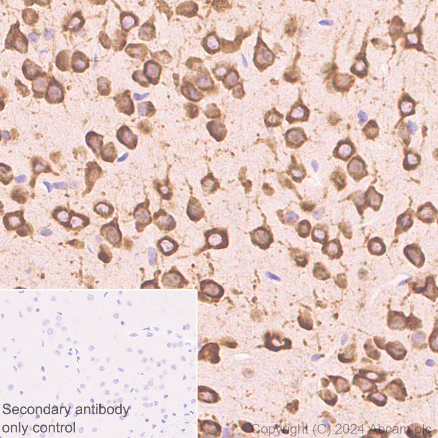 Immunohistochemistry (Formalin/PFA-fixed paraffin-embedded sections) - Anti-G3BP2 (isoform a) antibody [EPR27325-43] - BSA and Azide free (AB317688), expandable thumbnail