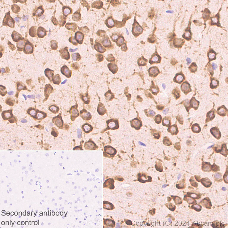Immunohistochemistry (Formalin/PFA-fixed paraffin-embedded sections) - Anti-G3BP2 (isoform a) antibody [EPR27325-43] - BSA and Azide free (AB317688)