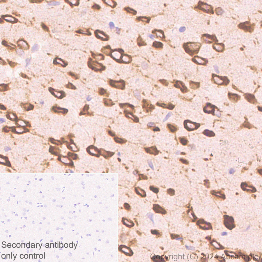Immunohistochemistry (Formalin/PFA-fixed paraffin-embedded sections) - Anti-G3BP2 (isoform a) antibody [EPR27325-43] - BSA and Azide free (AB317688), expandable thumbnail