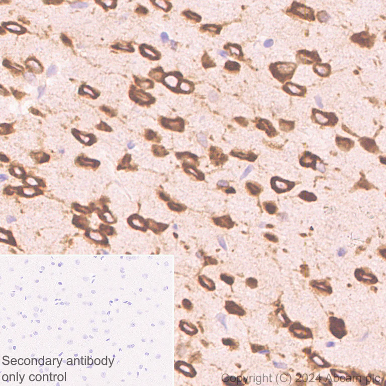 Immunohistochemistry (Formalin/PFA-fixed paraffin-embedded sections) - Anti-G3BP2 (isoform a) antibody [EPR27325-43] - BSA and Azide free (AB317688)
