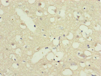 Immunohistochemistry (Formalin/PFA-fixed paraffin-embedded sections) - Anti-G5PR antibody (AB230347)