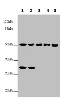 Western blot - Anti-G5PR antibody (AB230347)