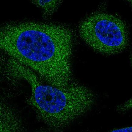 Immunocytochemistry/ Immunofluorescence - Anti-G6PC3 antibody (AB221647)