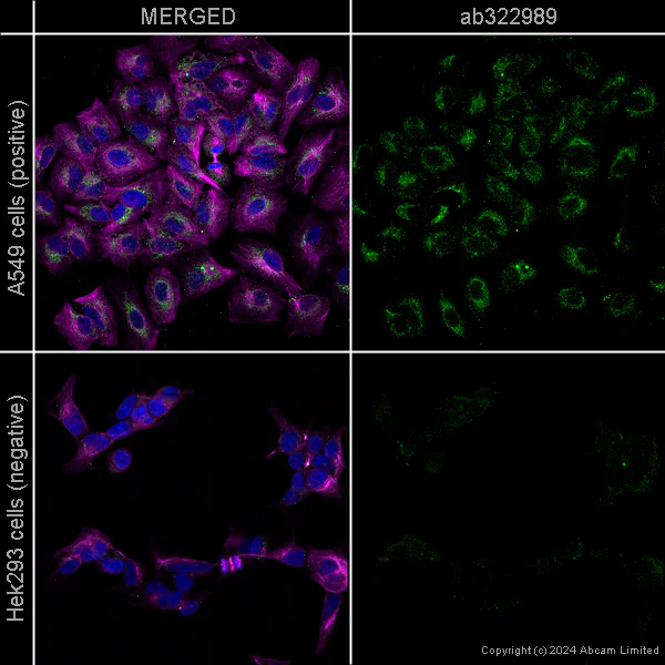 Immunocytochemistry/ Immunofluorescence - Anti-G6PD antibody [EPR20668] - Mouse IgG1 (Chimeric) - BSA and Azide free (AB322995)