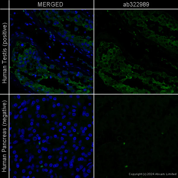 Immunohistochemistry (Formalin/PFA-fixed paraffin-embedded sections) - Anti-G6PD antibody [EPR20668] - Mouse IgG1 (Chimeric) - BSA and Azide free (AB322995)