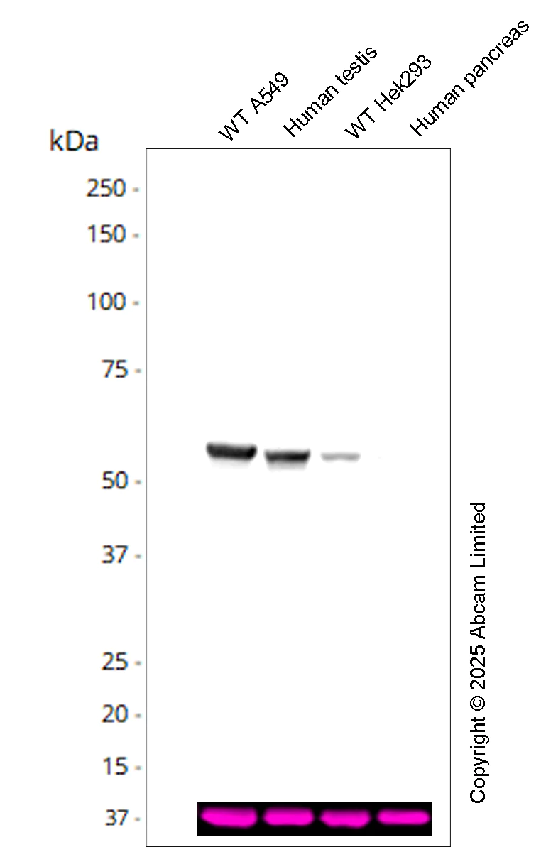 Western blot - Anti-G6PD antibody [EPR20668] - Mouse IgG1 (Chimeric) - BSA and Azide free (AB322995)