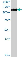 Western blot - Anti-GAA antibody (AB102815)