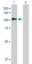 Western blot - Anti-GAA antibody (AB102815)