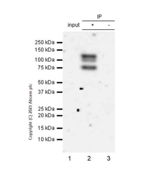 Immunoprecipitation - Anti-GAA antibody [EPR28363-56] (AB314448), expandable thumbnail