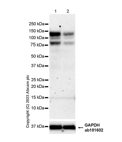Western blot - Anti-GAA antibody [EPR28363-56] - BSA and Azide free (AB314449)