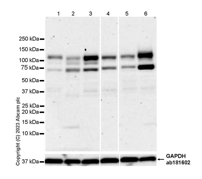 Western blot - Anti-GAA antibody [EPR28363-56] - BSA and Azide free (AB314449)
