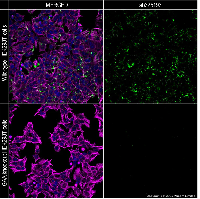 Immunocytochemistry/ Immunofluorescence - Anti-GAA antibody [EPR30339-80] (AB325193)