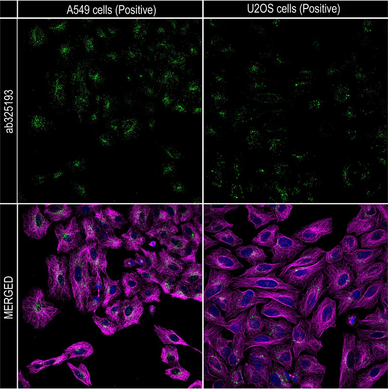 Immunocytochemistry/ Immunofluorescence - Anti-GAA antibody [EPR30339-80] (AB325193)