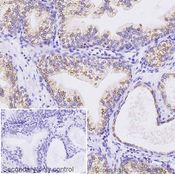 Immunohistochemistry (Formalin/PFA-fixed paraffin-embedded sections) - Anti-GAA antibody [EPR30339-80] (AB325193)