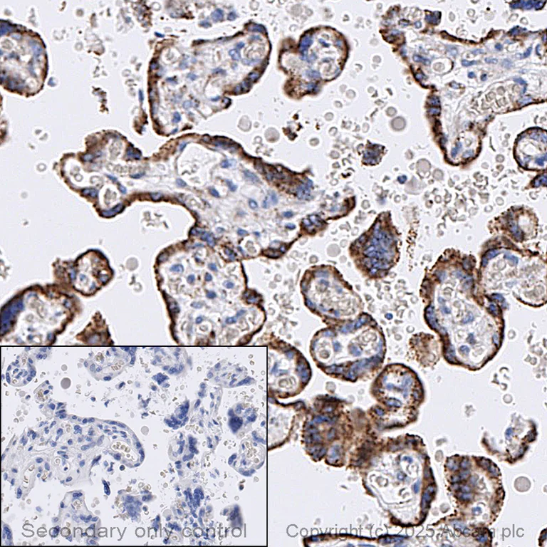 Immunohistochemistry (Formalin/PFA-fixed paraffin-embedded sections) - Anti-GAA antibody [EPR30339-80] (AB325193)