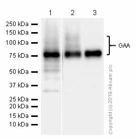 Western blot - Anti-GAA antibody [EPR4716(2)] (AB137068)