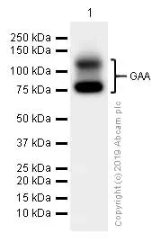 Western blot - Anti-GAA antibody [EPR4716(2)] - BSA and Azide free (AB240102)