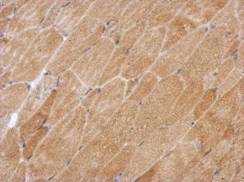 Immunohistochemistry (Formalin/PFA-fixed paraffin-embedded sections) - Anti-GAA1 antibody (AB126951), expandable thumbnail