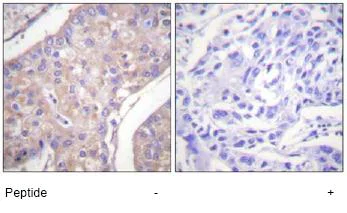 Immunohistochemistry (Formalin/PFA-fixed paraffin-embedded sections) - Anti-GAB1 antibody (AB59362)
