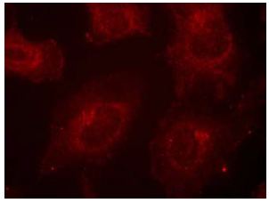 Immunocytochemistry/ Immunofluorescence - Anti-GAB1 (phospho Y627) antibody (AB131458)