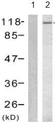 Western blot - Anti-GAB1 (phospho Y627) antibody (AB131458)