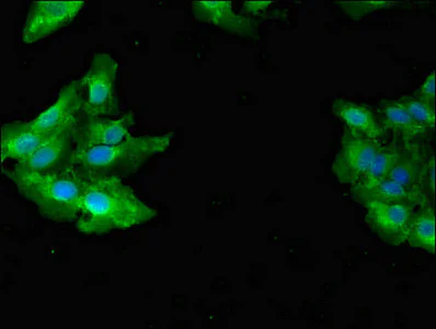 Immunocytochemistry/ Immunofluorescence - Anti-GAB2 antibody (AB235932)