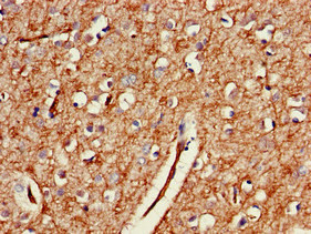 Immunohistochemistry (Formalin/PFA-fixed paraffin-embedded sections) - Anti-GAB2 antibody (AB235932)