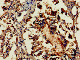 Immunohistochemistry (Formalin/PFA-fixed paraffin-embedded sections) - Anti-GAB2 antibody (AB235932)