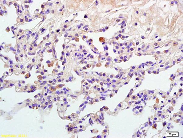 Immunohistochemistry (Formalin/PFA-fixed paraffin-embedded sections) - Anti-GAB2 (phospho Y452) antibody (AB203616)