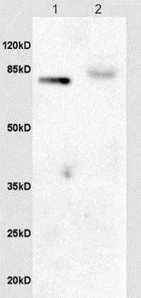 Western blot - Anti-GAB2 (phospho Y452) antibody (AB203616)