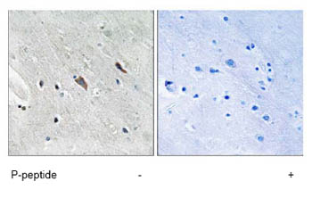 Immunohistochemistry (Formalin/PFA-fixed paraffin-embedded sections) - Anti-GAB2 (phospho Y643) antibody (AB78262)