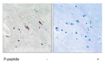 Immunohistochemistry (Formalin/PFA-fixed paraffin-embedded sections) - Anti-GAB2 (phospho Y643) antibody (AB78262)