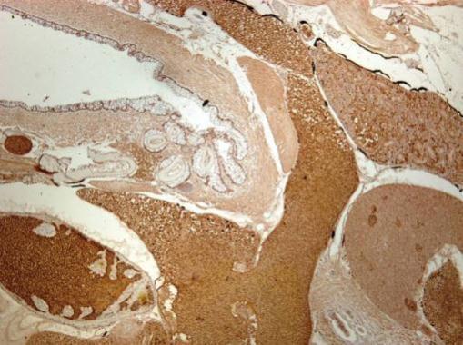 Immunohistochemistry (Formalin/PFA-fixed paraffin-embedded sections) - Anti-GABA A Receptor alpha 1 antibody (AB211131), expandable thumbnail