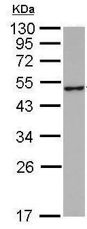 Western blot - Anti-GABA A Receptor alpha 1 antibody (AB211131), expandable thumbnail